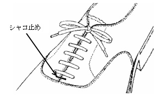 《シャコ止め》